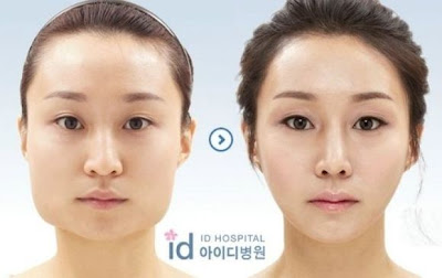 Korea Surgery ~ Kome Yang Suke Sangat Korea