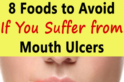 8 Foods to Avoid If You Suffer from Mouth Ulcers