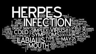 Herpes penyakit