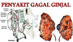 http://www.seh4t.com/2017/05/obat-gagal-ginjal.html