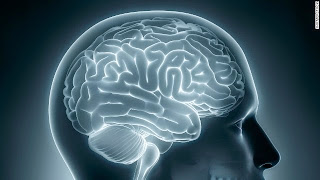 Pildiotsingu brain imaging google short term memory tulemus