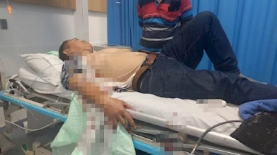 Korban Deddi debt collector di Palembang mengalami luka tusuk yang dilakukan oknum anggota polisi