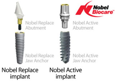 Implant giá tốt nhất tại Đăng Lưu