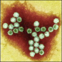 NOROVIRUS