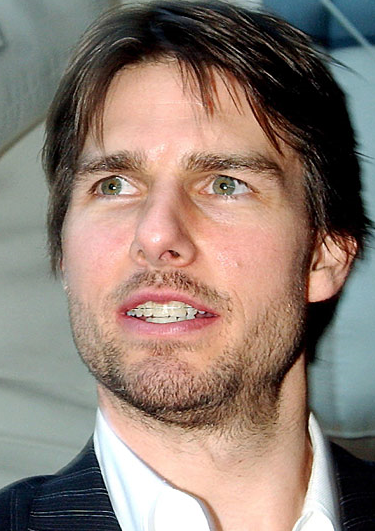 tom cruise teeth. Tom Cruise had braces?