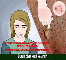 obat kutil kelamin,tanda kutil kelamin,gejala kutil kelamin,ciri ciri kutil kelamin,muncul kutil di sekitar kelamin,obat kutil tanpa operasi,cara menghilagkan kutil kelamin tanpa operasi