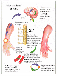 Mechanism of RSD