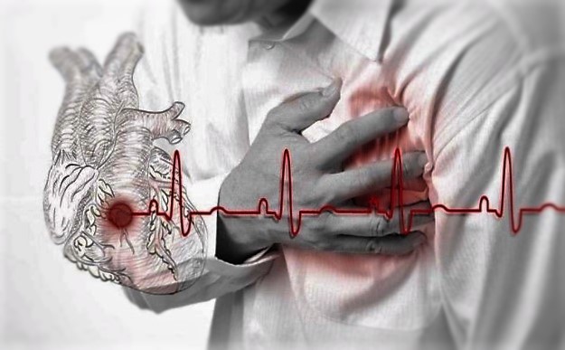 8 Hal Yang Menjadi Pemicu Serangan Jantung Yang Harus diwaspadai 