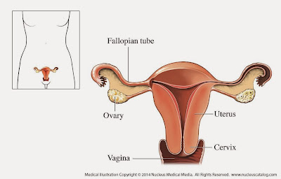 Kandiasis Vagina
