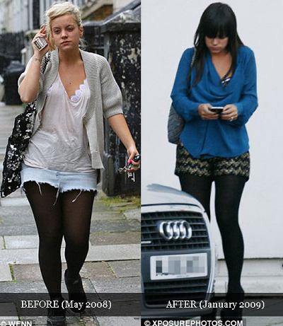 weight loss before and after. weight loss before and after. weight loss before and after.