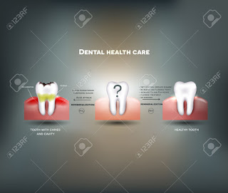 Complete Dental Care Tips