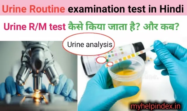 Urine routine test  in Hindi | Urine R/M test kya hota hai in Hindi. 
