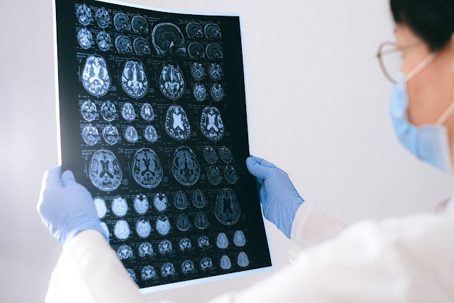  The Scary Reality of Covid-19: It Can Cause Brain Alterations