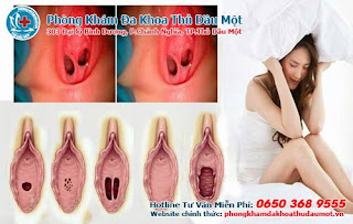 Những dấu hiệu về màng trinh cần biết