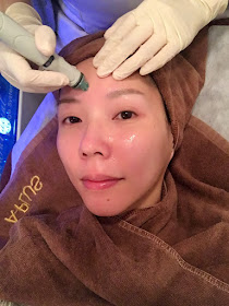 A-PLUS_Hydrafacial_06