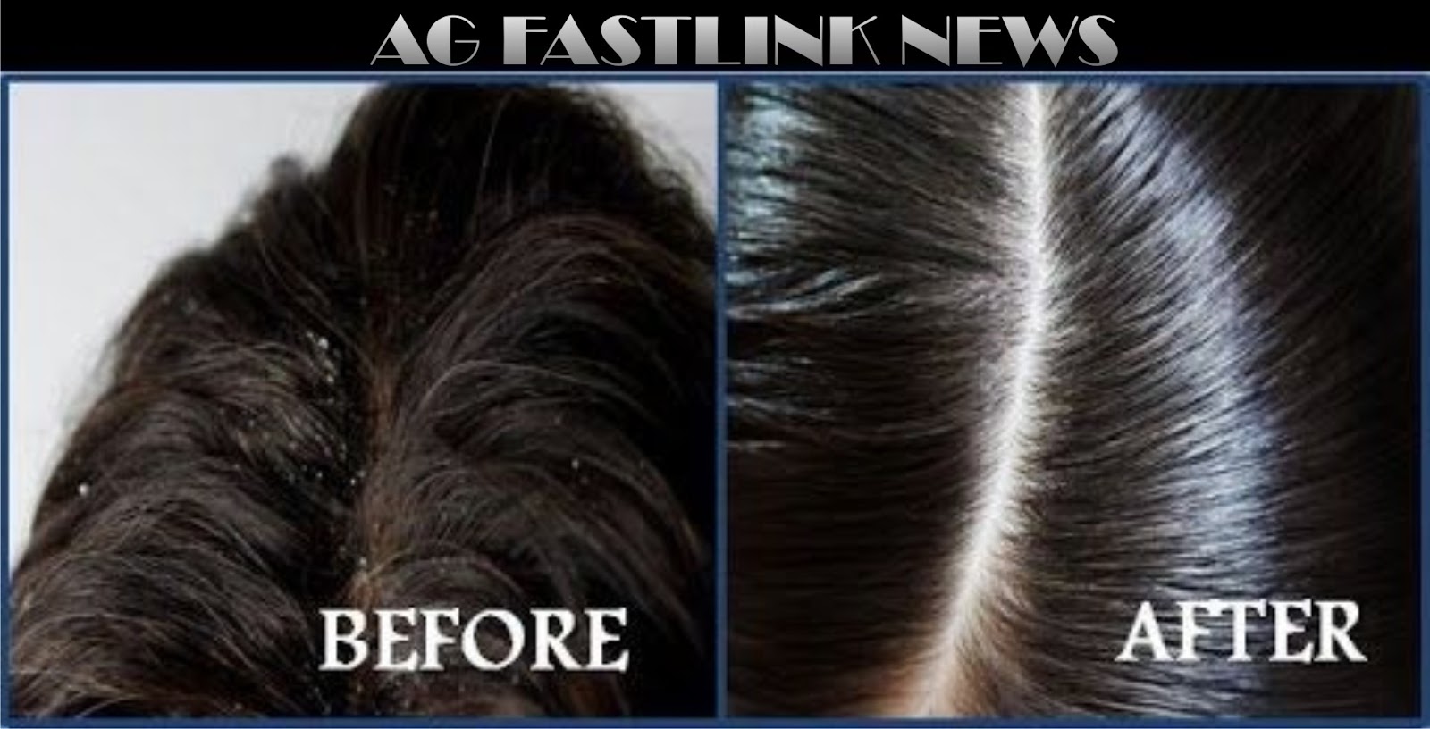 Ag Fastlink News 2 Tested Remedies To Get Rid Of Itchiness