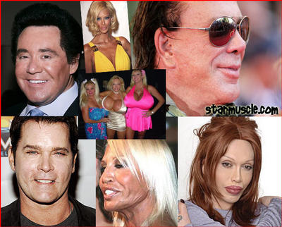 Celebrity Stars Hollywood on Look Your Best With Botched Celebrity Plastic Surgery