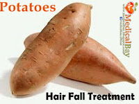 Potatoes Hair loss treatment, Potatoe hair fall loss remedy and treatment