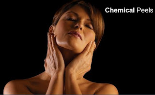 Chemical Peels