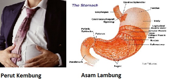 Penyebab Kembung Dan Cara Mengatasi Kembung | Farmasi ...