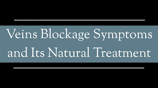 Veins Blockage Symptoms and Its Natural Treatment veins blockage 