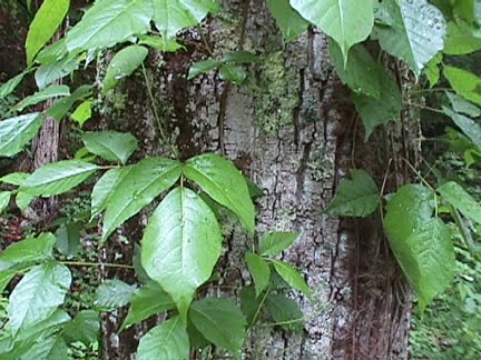 poison sumac rashes. poison sumac rash on face.