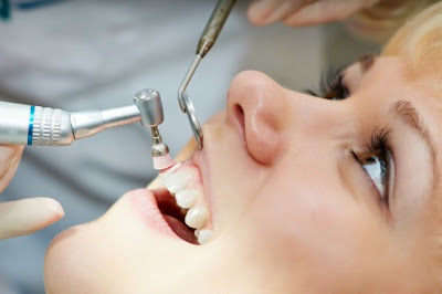Cao răng bị vàng có nguy hiểm không?