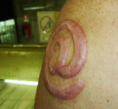 Weird Skin Burning Tattoos | painful Tattoos