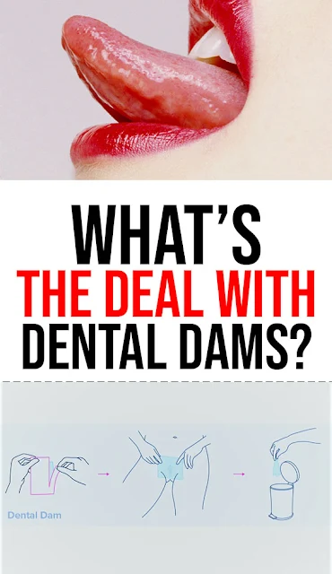 What’s The Deal With Dental Dams?