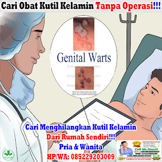 Obat Kutil Kelamin