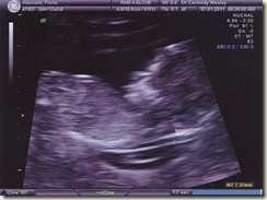 12wkScan