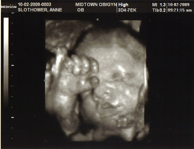 Baby Born Weeks on Good In Fact They Took A 4 D Picture Of The Baby Inside My Womb Can