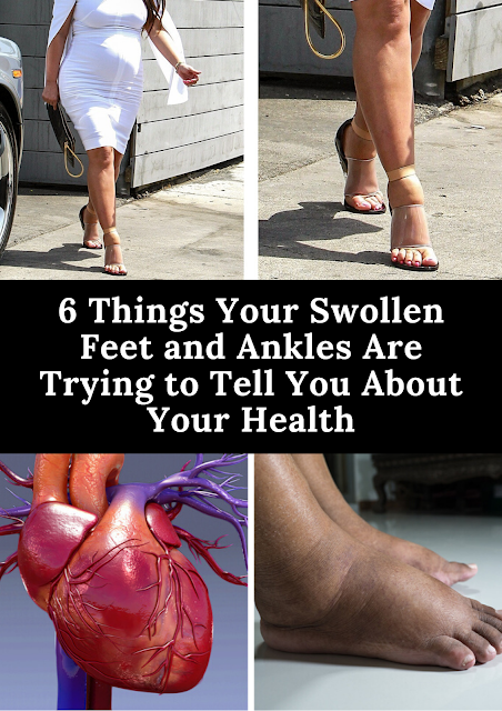 6 Things Your Swollen Feet And Ankles Are Trying To Tell You About Your Health