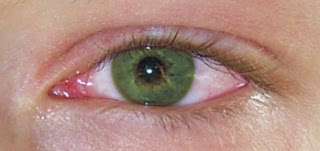 Mari Mengungkap! Tentang Mitos Penyakit Mata Merah Yang Bisa Menular Lewat Saling Pandang