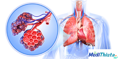 Causes Of Chest Pain