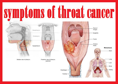 throat cancer | symptoms of throat cancer | signs of throat cancer | throat and neck cancer | how do you get throat cancer | what is throat cancer | head and throat cancer |throat cancer stages | throat cancer image | symptoms of throat cancer image | signs of throat cancer image | throat and neck cancer image | how do you get throat cancer image | what is throat cancer image | head and throat cancer image | throat cancer stages image | throat cancer prognosis | throat cancer prognosis image | throat cancer survival rate | throat cancer survival rate image | throat cancer treatment | throat cancer treatment image