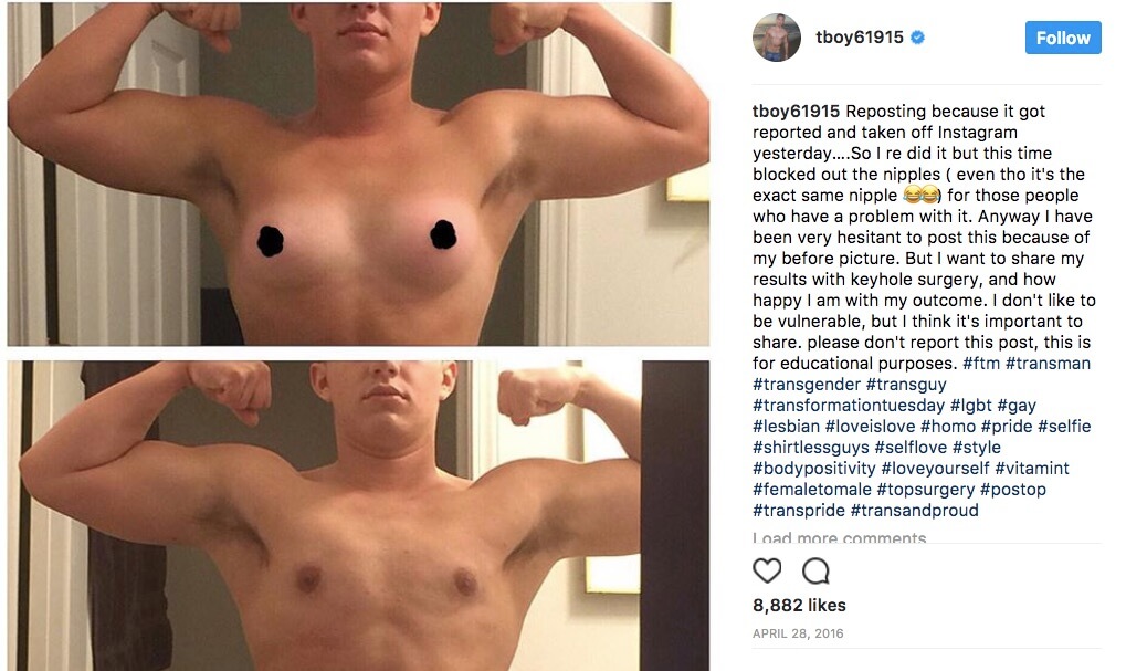 Transgender Man Posts His Before And After Pictures To Send A Positive Message