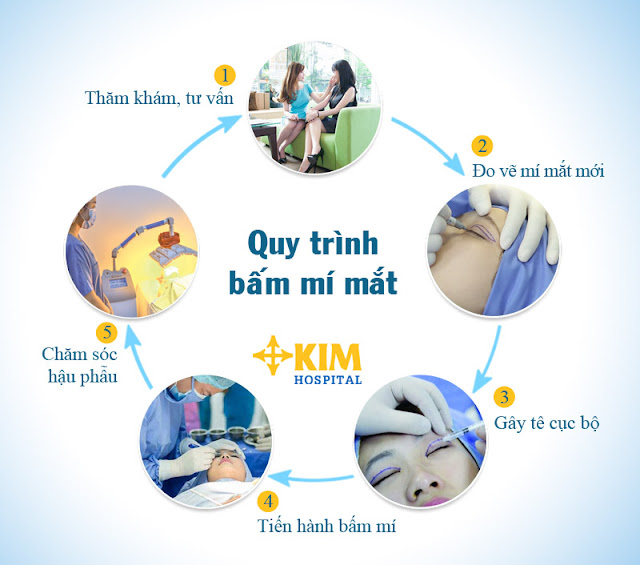 Tìm hiểu về phương pháp tạo mắt ha mí đẹp như sao Hàn 2