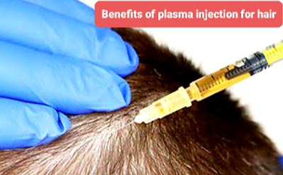 Benefits of plasma injection for hair    فوائد واستخدامات حقن البلازما للشعر