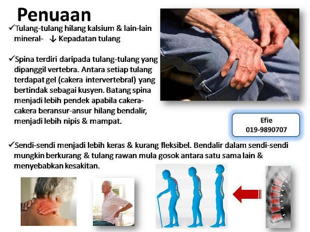 Beli Ubat Sakit Lutut Di Farmasi - Contoh 0917