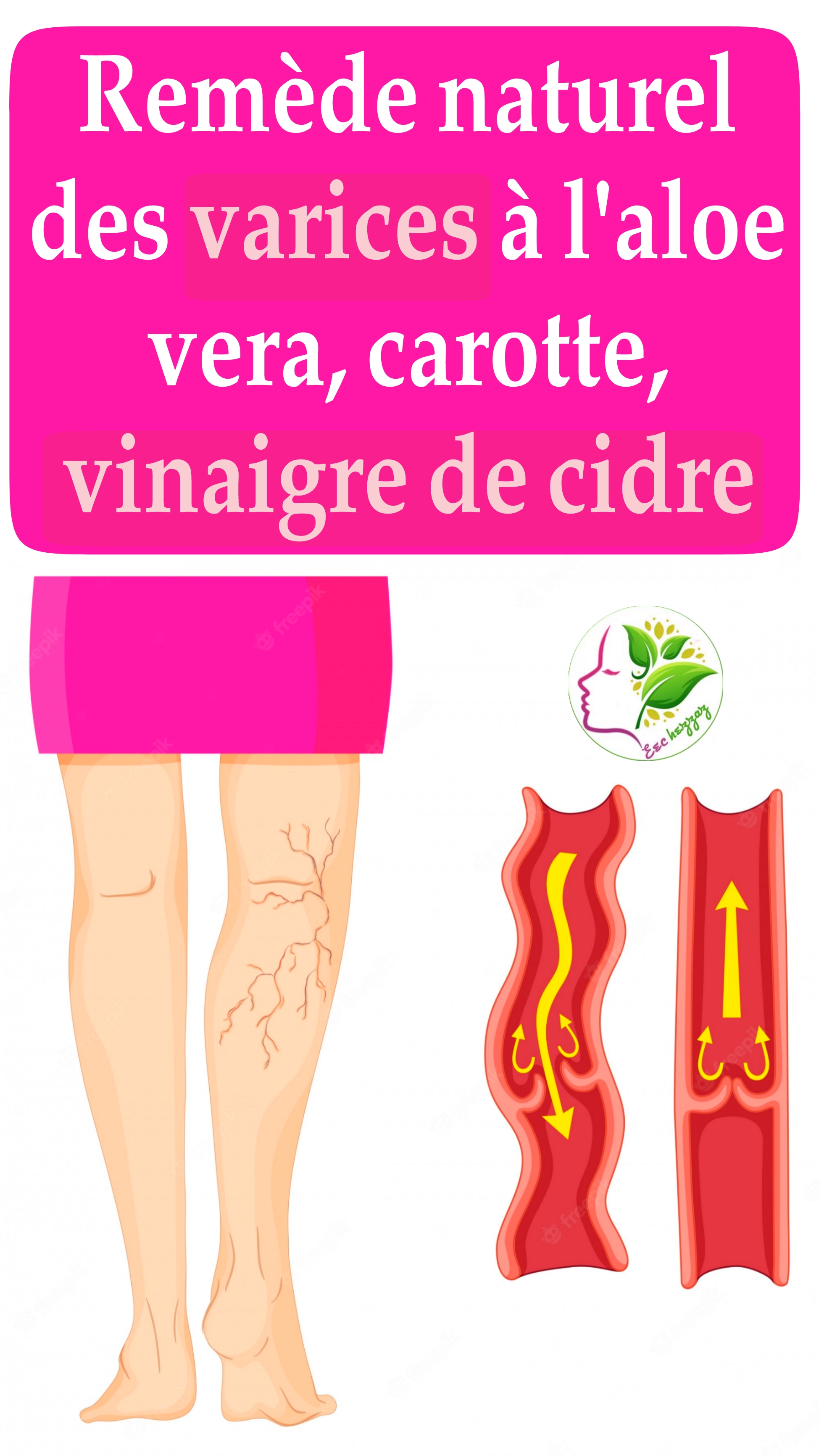 Remède naturel des varices à l'aloe vera, carotte, vinaigre de cidre