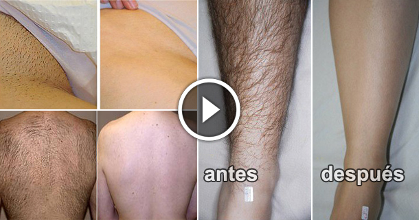 How To Naturally Remove Body Hair Permanently