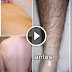 How To Naturally Remove Body Hair Permanently