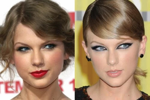 Has Taylor Swift Had Cosmetic Surgery