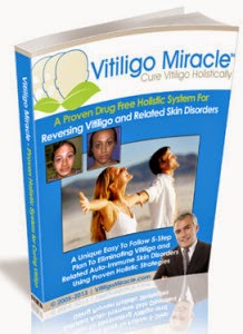 Vitiligo Miracle Review - Eliminate Your Vitiligo Forever