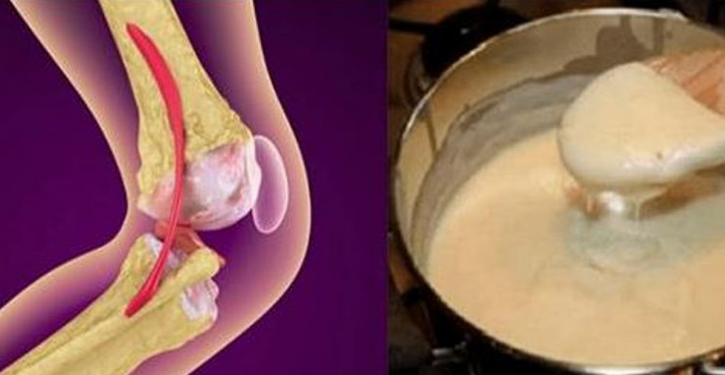 An Effective Natural Recipe For Rebuilding Bones And Knee Joints