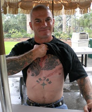 his neo-Nazi tattoos.