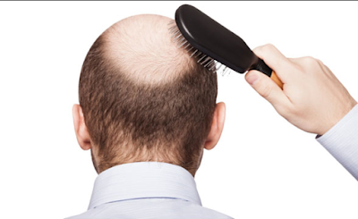 Is hair loss treatment is only one big scam? Please read this article to find out.