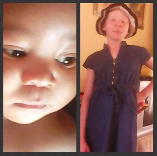  Photos: Kidnapped 13-year-old albino girl and her 15-month-old nephew found murdered in South Africa