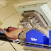 El uso de semillas de radiación para tratar el cáncer de próstata